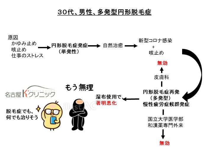 円形脱毛症　病院
